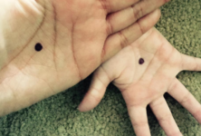 Black dot campaign : Une campagne contre les violences conjugales